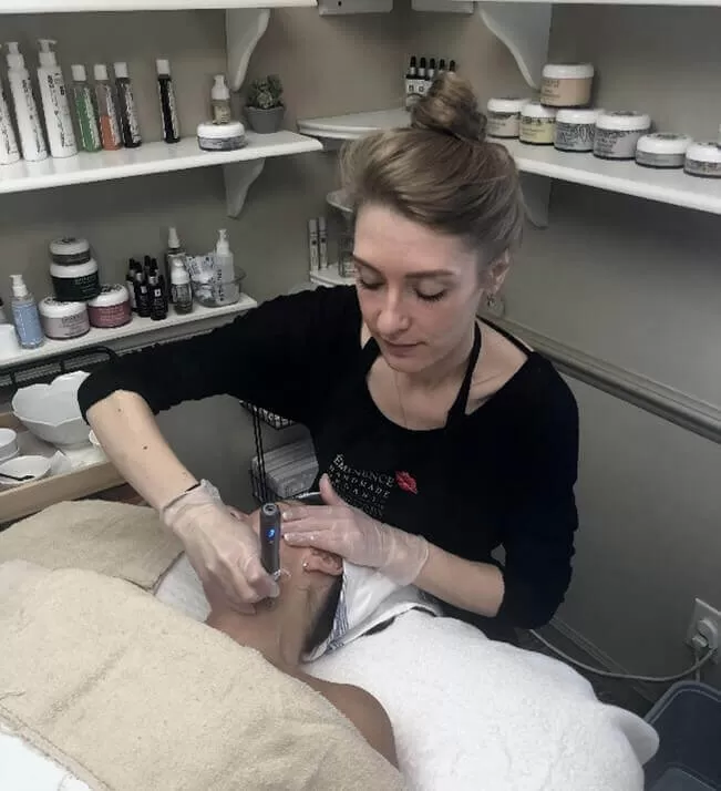 Micro Needling Wellness Origin Carmel Indiana Spa