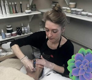 Micro Needling Wellness Origin