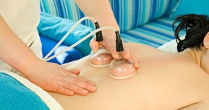Cupping & Vacuum Body Sculpting Carmel Indiana