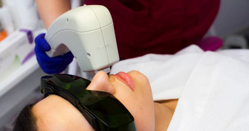 Laser Hair Removal Carmel Indiana Spa IPL Photofacial