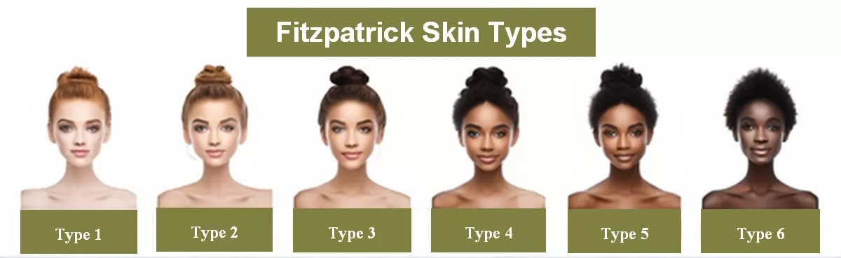 fitzpatrick skin-types WO