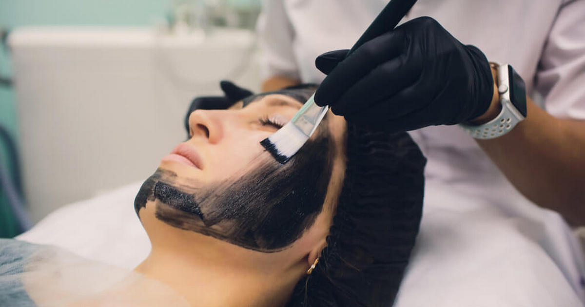 Laser Carbon Peel Treatment Carmel Indiana A