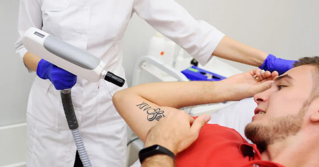 Laser Tattoo Removal D 1200 Tin